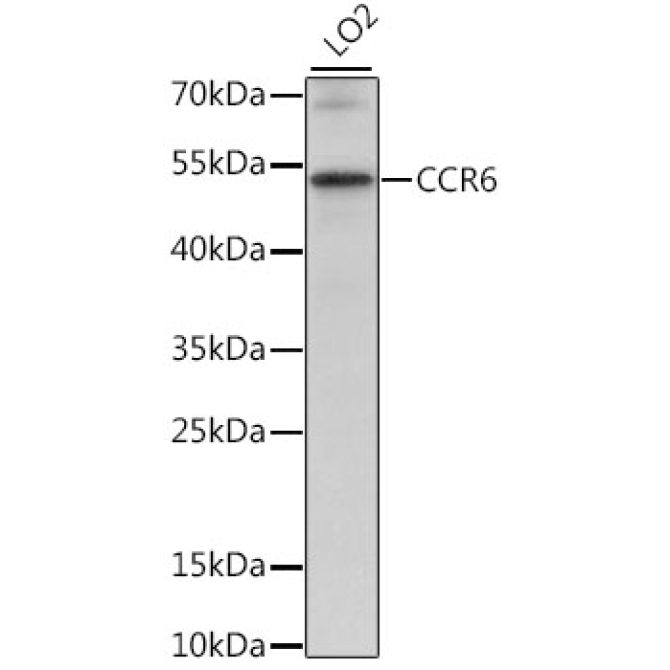CCR6 Rabbit Polyclonal Antibody