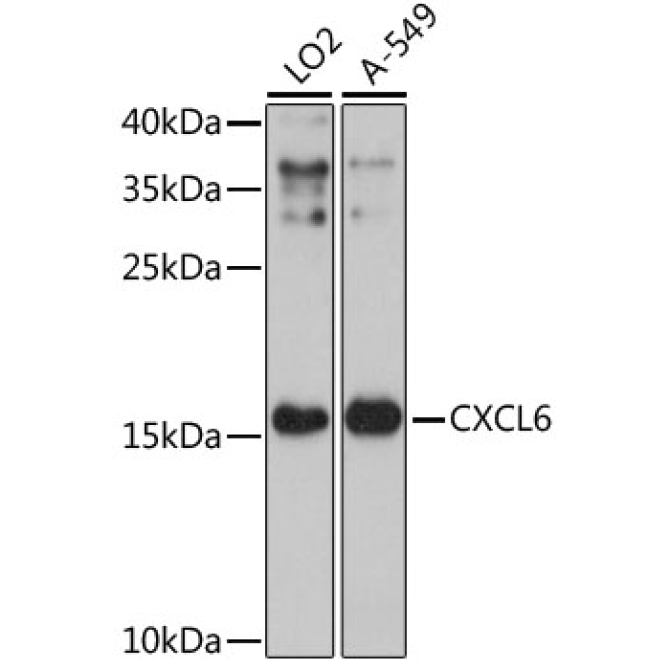 CXCL6 Rabbit Polyclonal Antibody