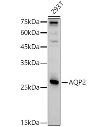 AQP2 Rabbit Polyclonal Antibody