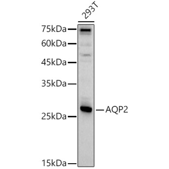 AQP2 Rabbit Polyclonal Antibody