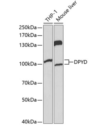 DPYD Rabbit Polyclonal Antibody