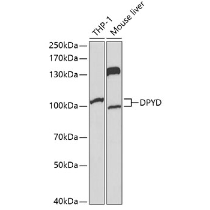 DPYD Rabbit Polyclonal Antibody
