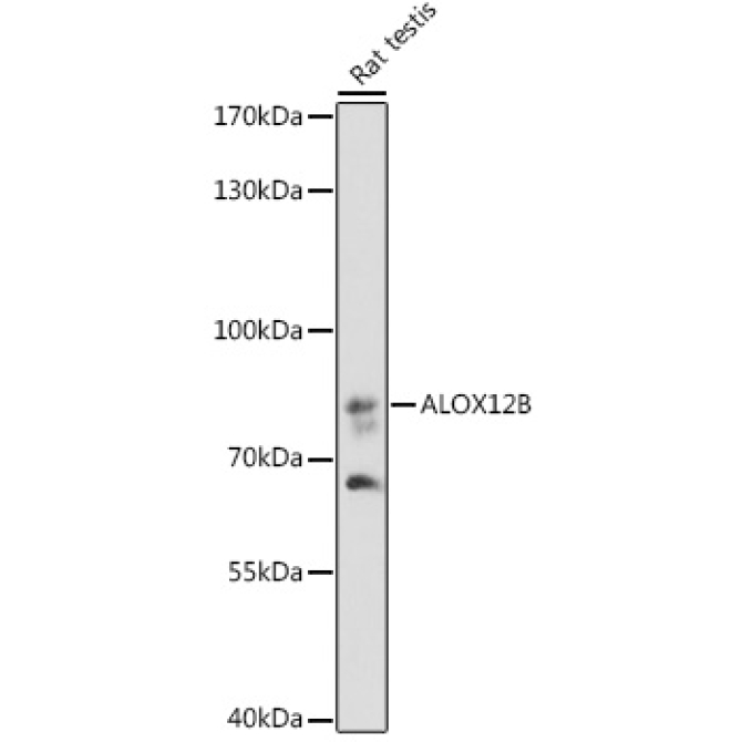 ALOX12B Rabbit Polyclonal Antibody