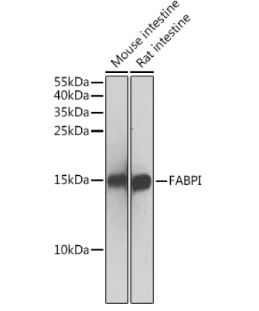 FABPI Rabbit Polyclonal Antibody