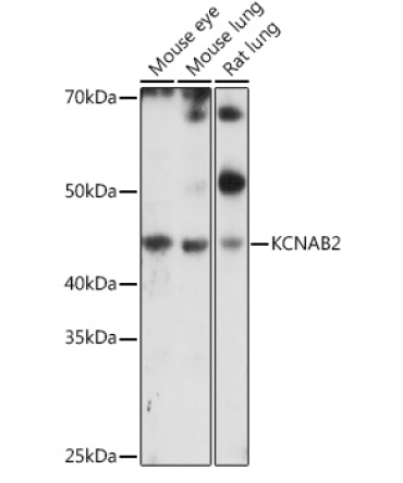 KCNAB2 Rabbit Polyclonal Antibody
