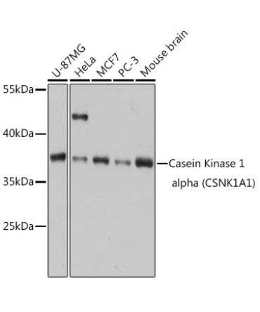 Casein Kinase 1 alpha (CSNK1A1) Rabbit Polyclonal Antibody