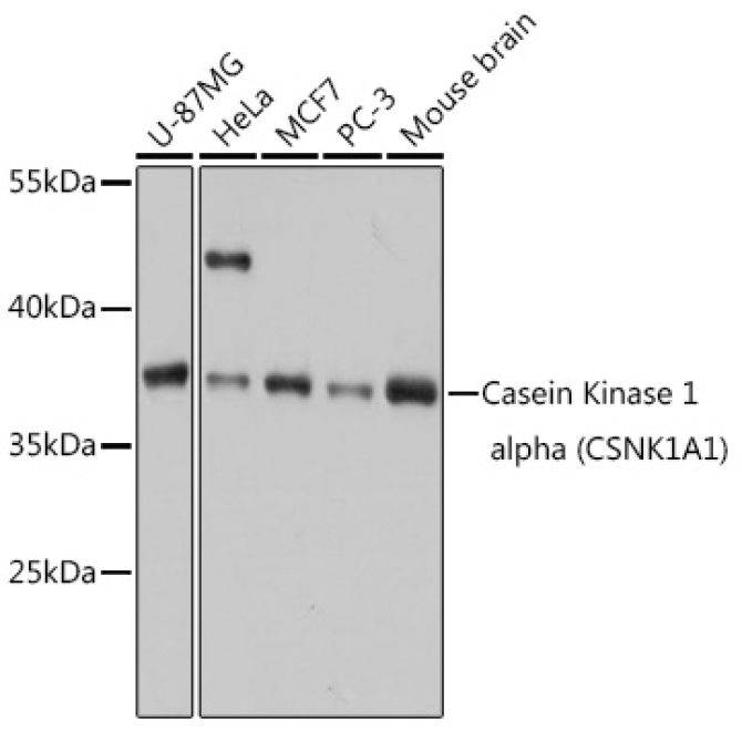 Casein Kinase 1 alpha (CSNK1A1) Rabbit Polyclonal Antibody