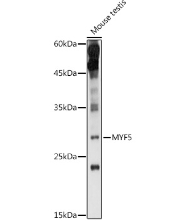 MYF5 Rabbit Polyclonal Antibody