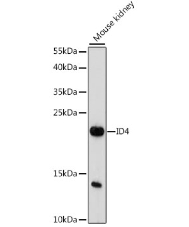 ID4 Rabbit Polyclonal Antibody