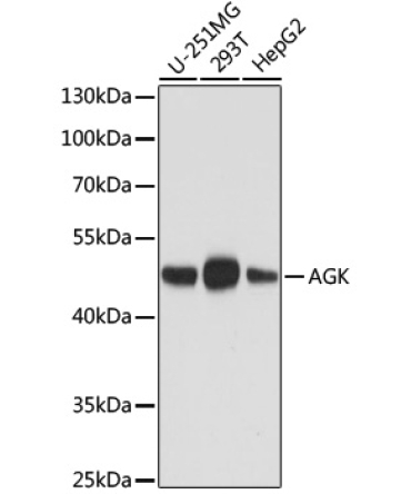 AGK Mouse Monoclonal Antibody