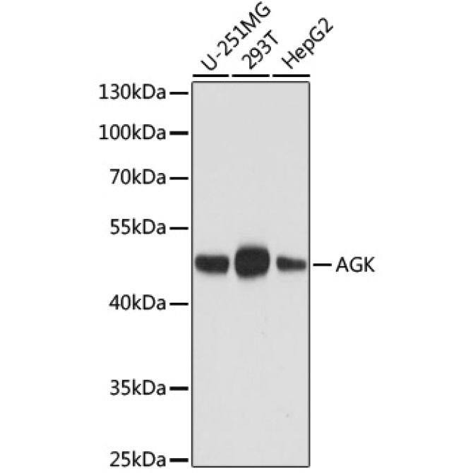 AGK Mouse Monoclonal Antibody