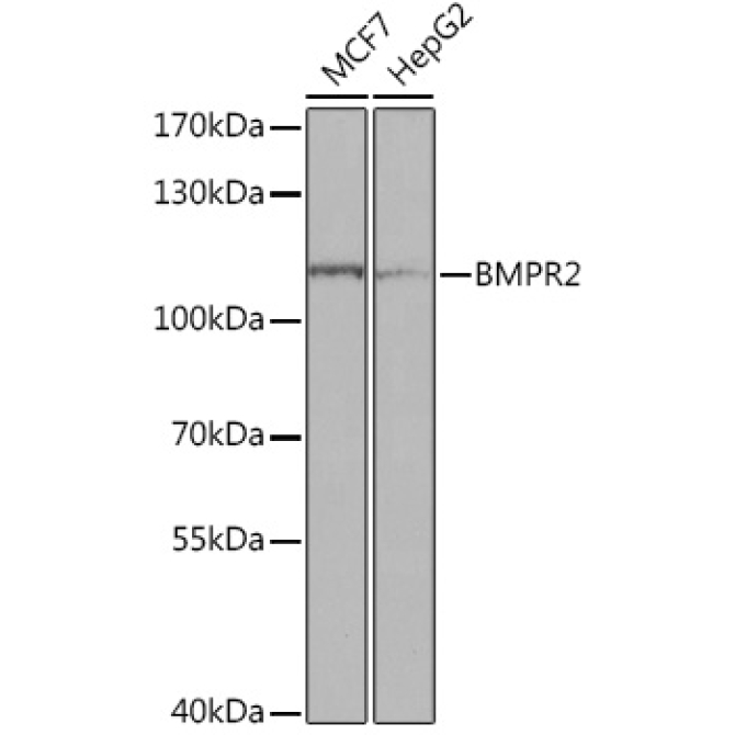 BMPR2 Rabbit Polyclonal Antibody