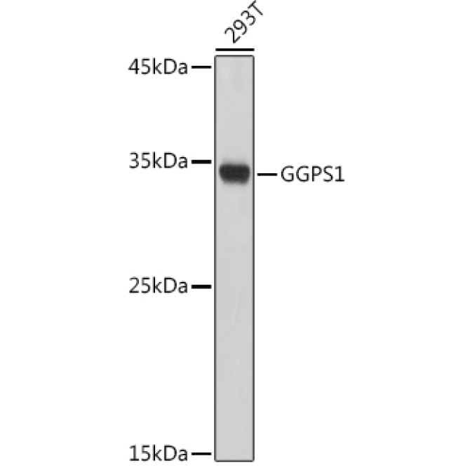 GGPS1 Rabbit Polyclonal Antibody