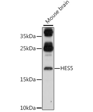 HES5 Rabbit Polyclonal Antibody