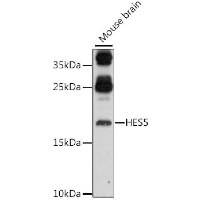 HES5 Rabbit Polyclonal Antibody