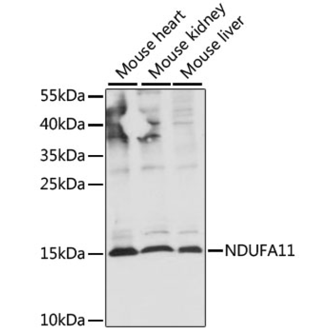 NDUFA11 Rabbit Polyclonal Antibody
