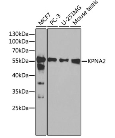 KPNA2 Rabbit Polyclonal Antibody