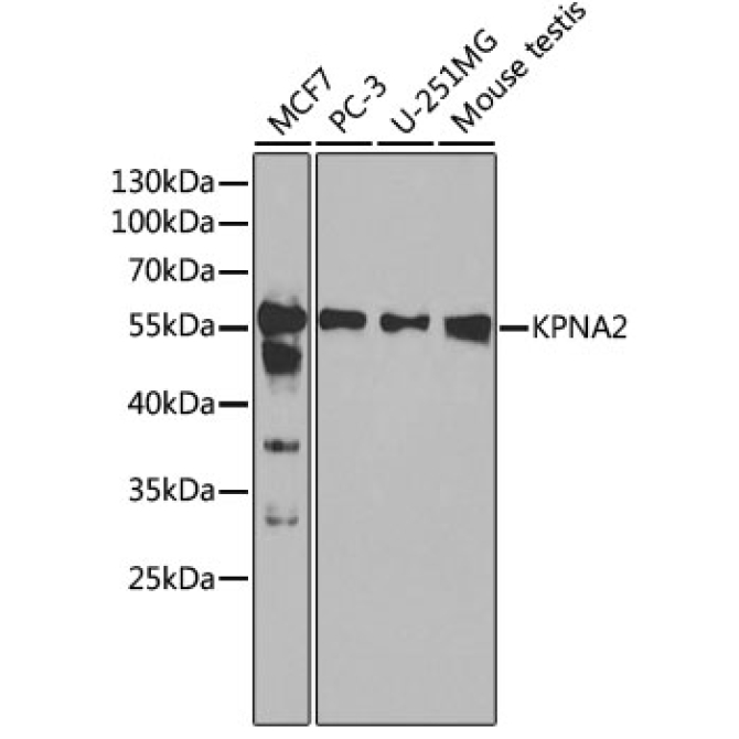 KPNA2 Rabbit Polyclonal Antibody