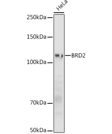BRD2 Rabbit Polyclonal Antibody
