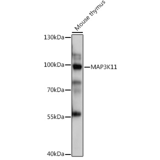MAP3K11 Rabbit Polyclonal Antibody