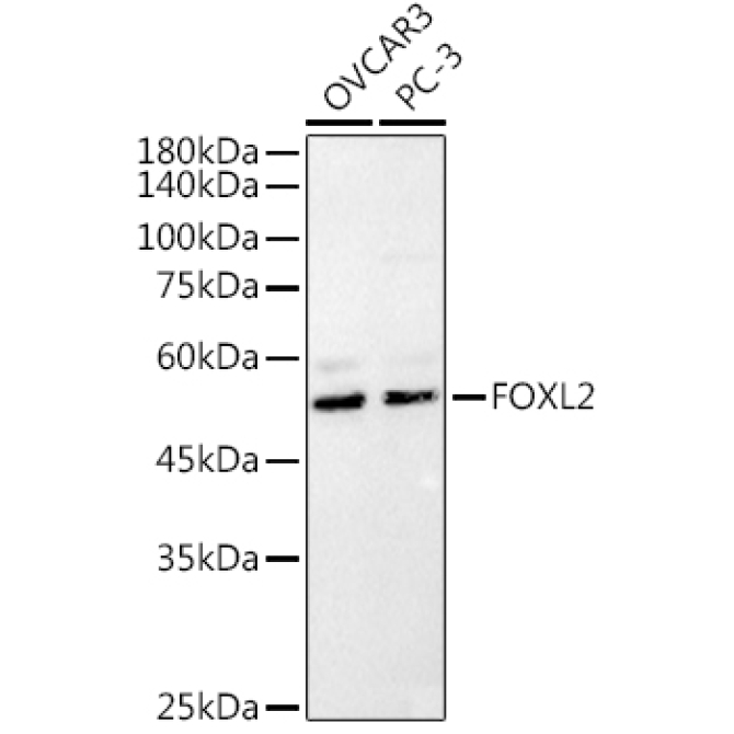 FOXL2 Rabbit Polyclonal Antibody