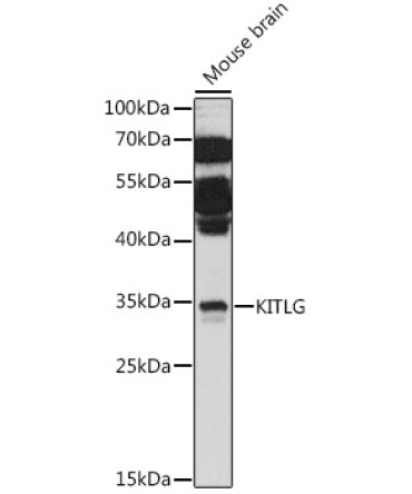 KITLG Rabbit Polyclonal Antibody