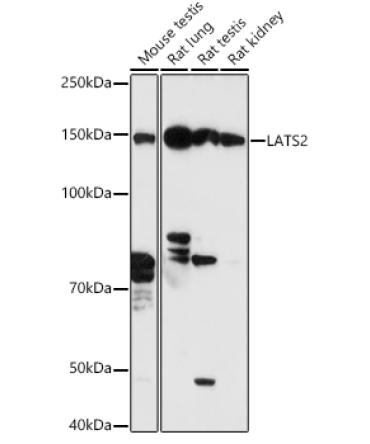 LATS2 Rabbit Polyclonal Antibody