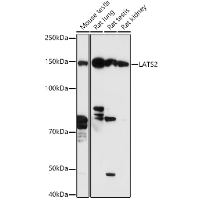 LATS2 Rabbit Polyclonal Antibody