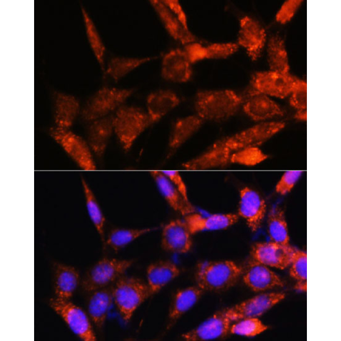 COX6C Rabbit Polyclonal Antibody