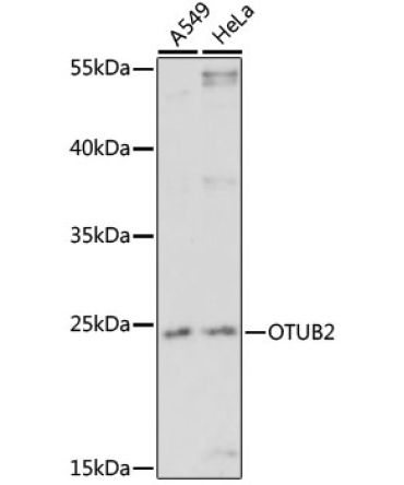 OTUB2 Rabbit Polyclonal Antibody