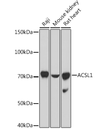 ACSL1 Rabbit Polyclonal Antibody