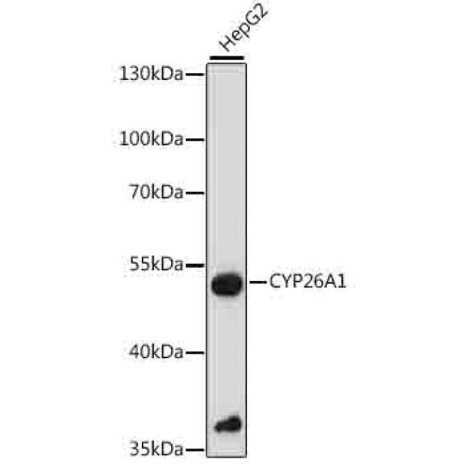 CYP26A1 Rabbit Polyclonal Antibody