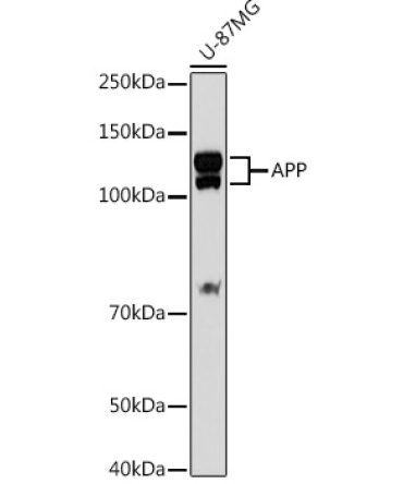 APP Rabbit Polyclonal Antibody [KO Validated]