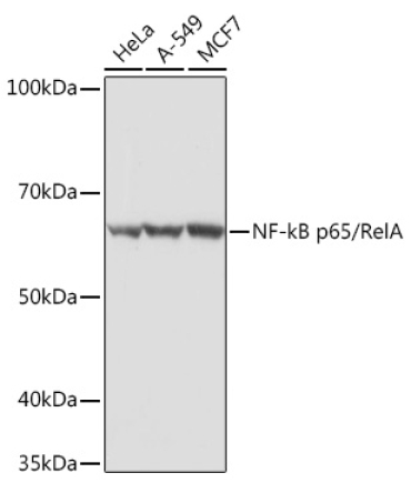 NF-kB p65/RelA Rabbit Polyclonal Antibody