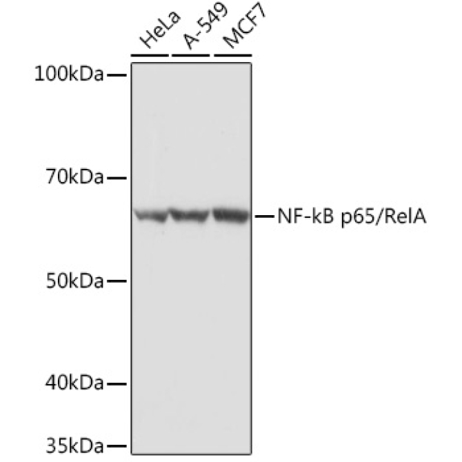 NF-kB p65/RelA Rabbit Polyclonal Antibody