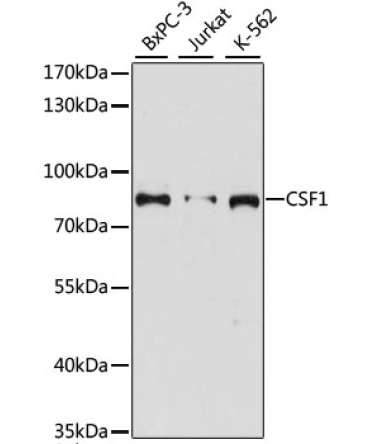 CSF1 Rabbit Polyclonal Antibody