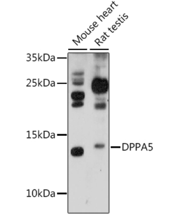 DPPA5 Rabbit Polyclonal Antibody