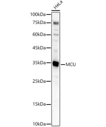 MCU Rabbit Polyclonal Antibody