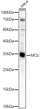 MCU Rabbit Polyclonal Antibody