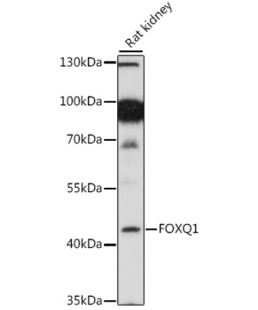 FOXQ1 Rabbit Polyclonal Antibody