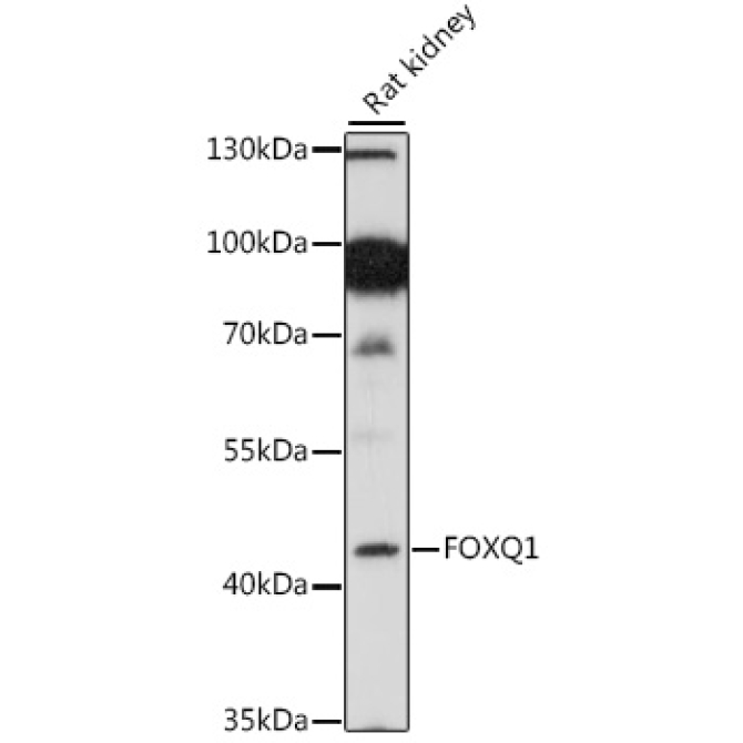 FOXQ1 Rabbit Polyclonal Antibody