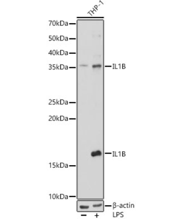 IL1Beta Rabbit Polyclonal Antibody