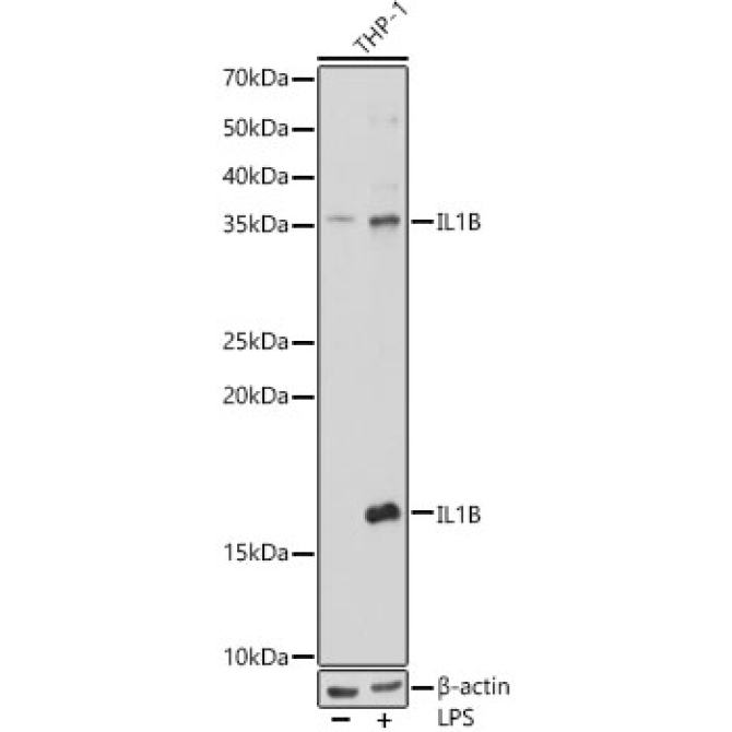 IL1Beta Rabbit Polyclonal Antibody
