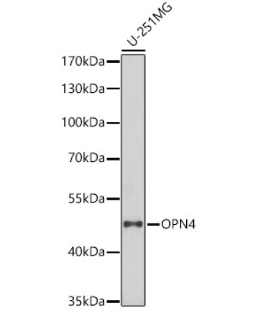 OPN4 Rabbit Polyclonal Antibody