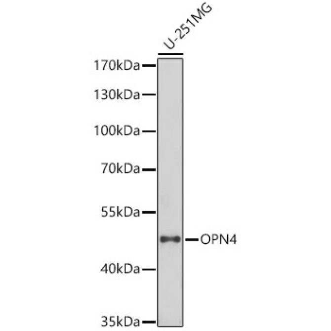 OPN4 Rabbit Polyclonal Antibody