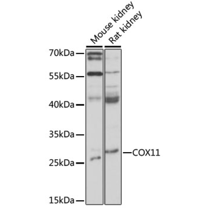 COX11 Rabbit Polyclonal Antibody