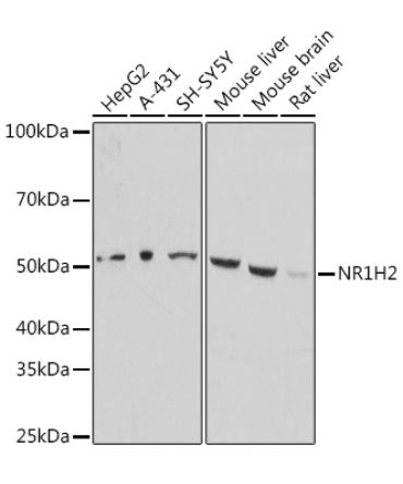 LXR beta/NER Rabbit Polyclonal Antibody