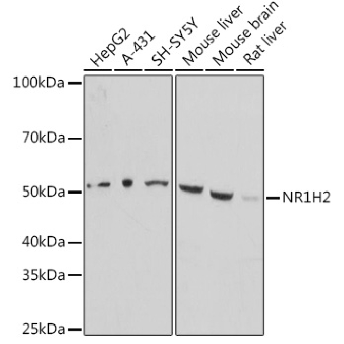 LXR beta/NER Rabbit Polyclonal Antibody