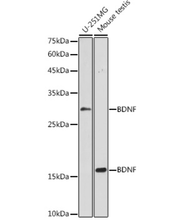 BDNF Rabbit Polyclonal Antibody