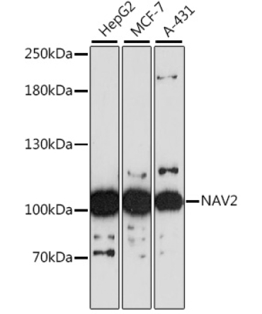 NAV2 Rabbit Polyclonal Antibody